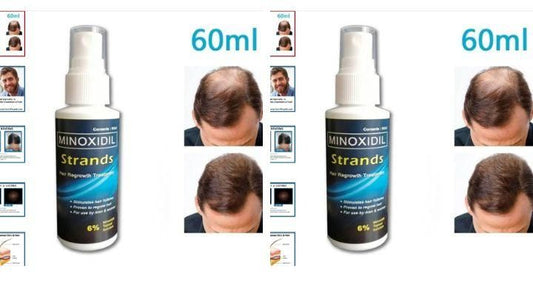 Strands 6% Minoxidil Topical Solution for Men 60ml for Hair Growth & Anti Hair Loss (Pack of 2)