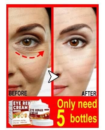 Under Eye Repair Cream (Pack of 2) | Dark Circles Repair Cream |