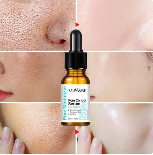 Pore Shrinking Face Serum Remover Blackheads | Dark Spots, Acne Treatment Oil | Controls Moisturizing | Improves Dull Skin Care (30 ml)