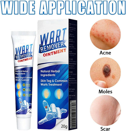 Warts Off Instant Blemish Removal Cream 20g | Wart Remover Ointment for All Skin Types (Pack of 1)