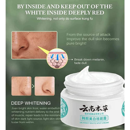 HOT JAPANESE Melasma Cream | White Spots Removal Cream | Skin Care Face Moisturizer Whitening Cream (Pack of 2)